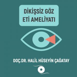 Dikişsiz Göz Eti Ameliyatı