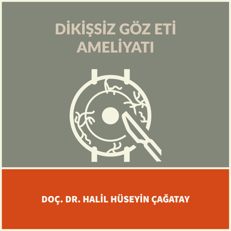 Dikişsiz Göz Eti Ameliyatı