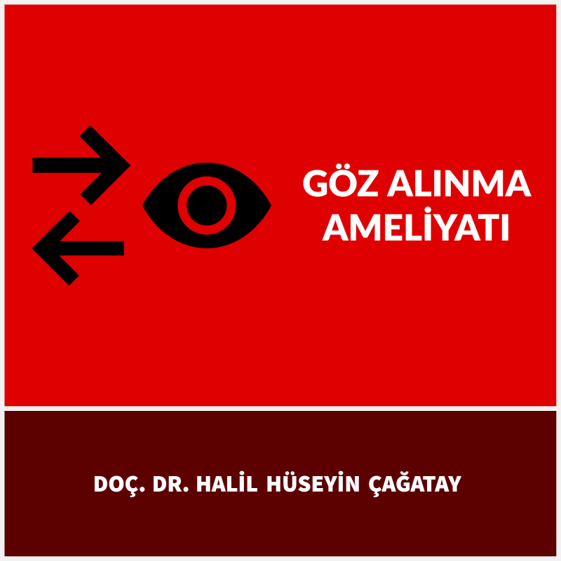 Göz Alınma Ameliyatı