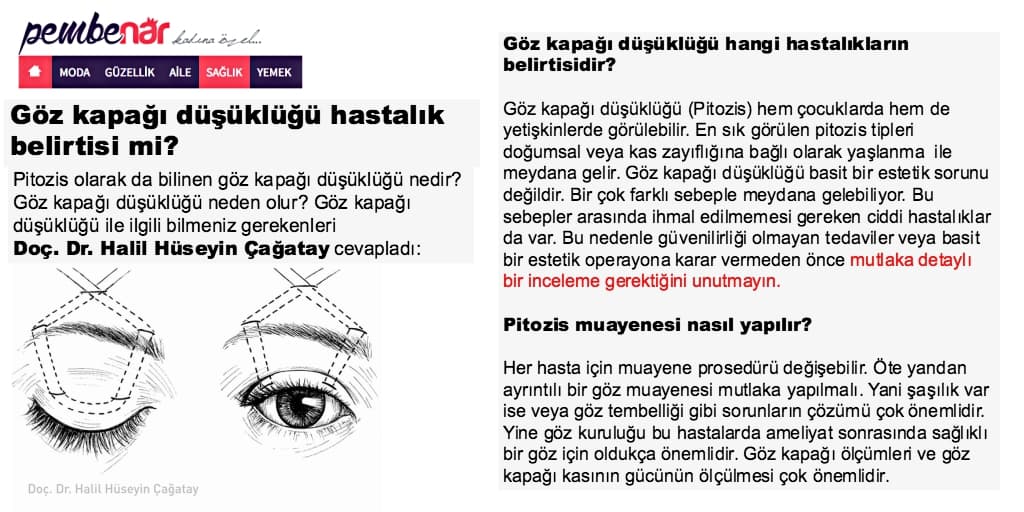 göz kapağı düşüklüğü belirtileri