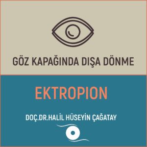 Göz Kapağında Dışa Dönme