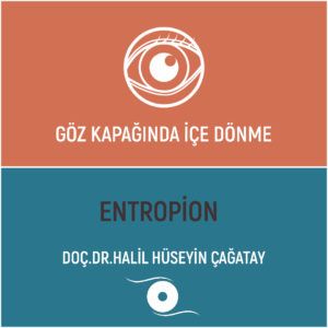 Göz Kapağında İçe Dönme