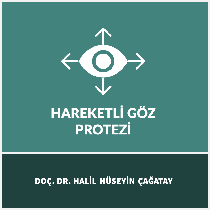 Hareketli Göz Protezi