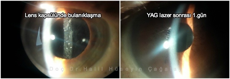 1. Gün