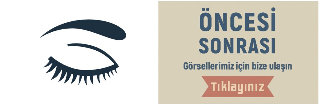 Öncesi Sonrası