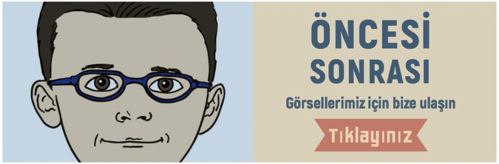 Öncesi Sonrası