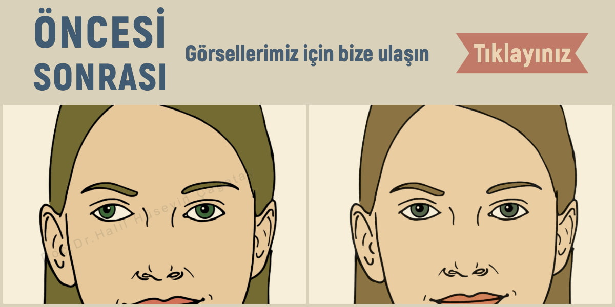 Öncesi Sonrası