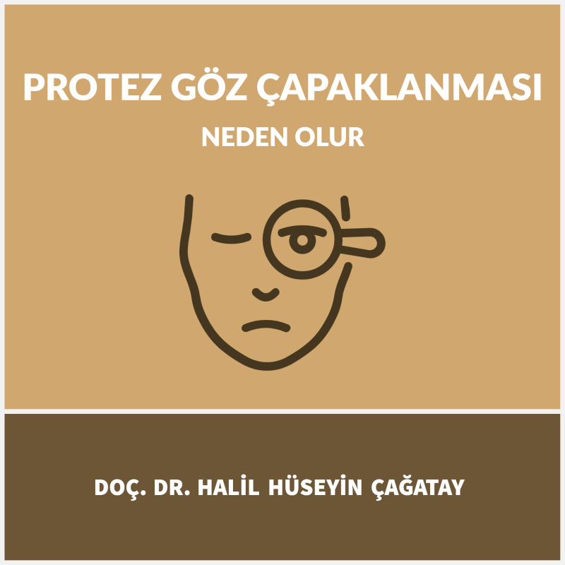 Protez Göz Çapaklanması