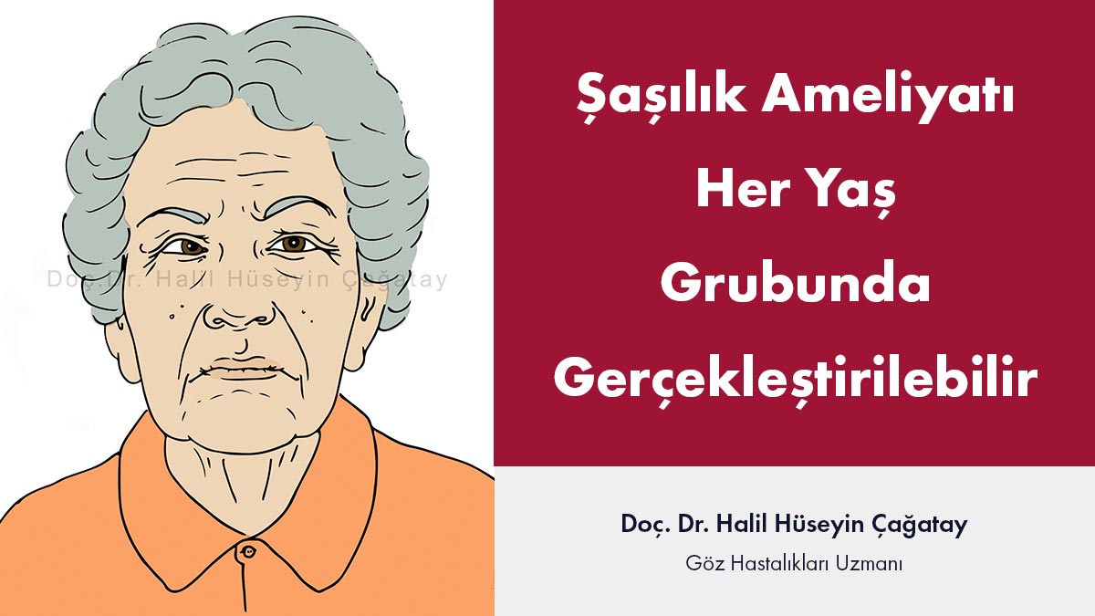 şaşılık ameliyatı yaşı