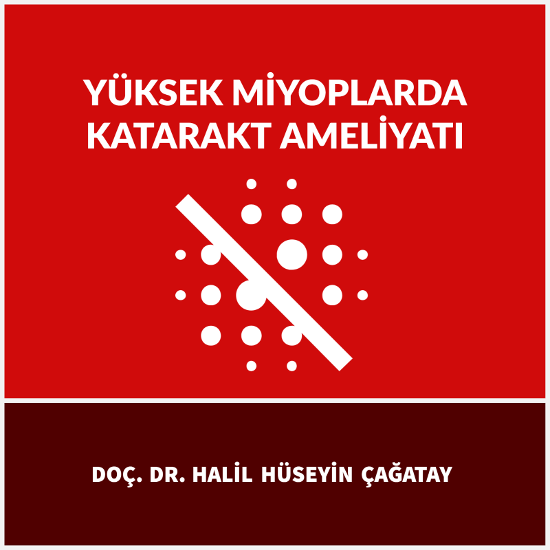 Yüksek Miyoplarda Katarakt Ameliyatı