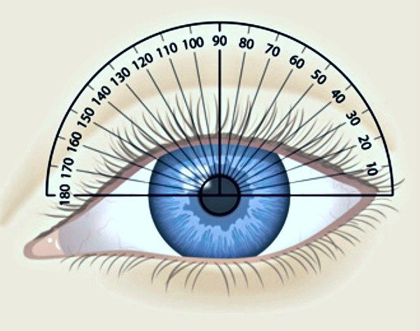 Astigmat