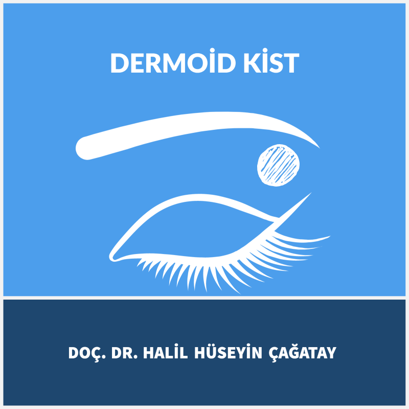 Dermoid Kist