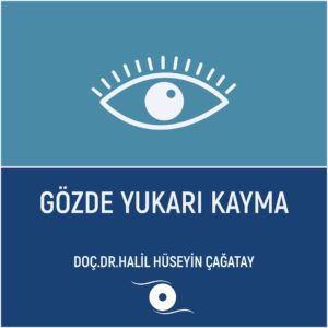 Gözde Yukarı Kayma