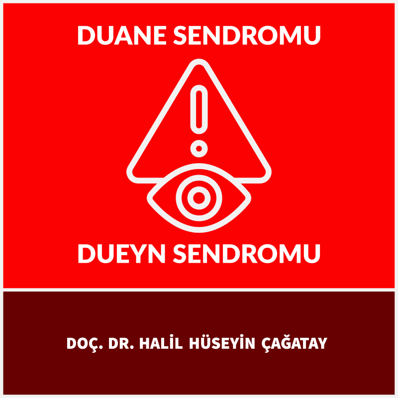 Duane Sendromu