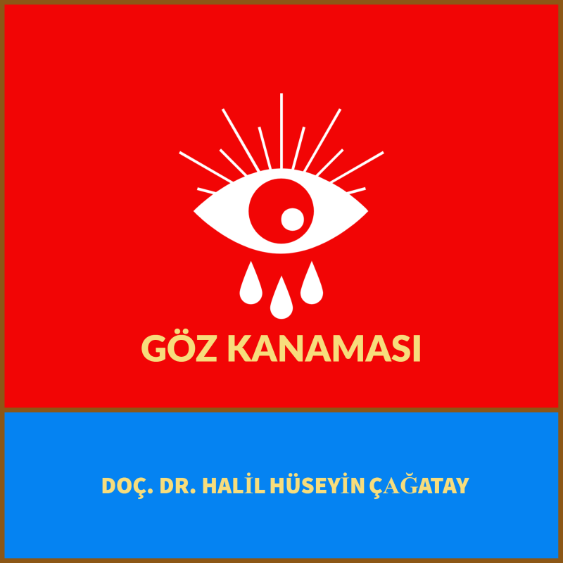 Göz Kanaması