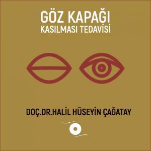 Göz Kapağı Kasılması