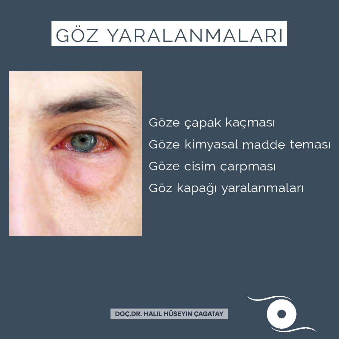 Göz Yaralanması