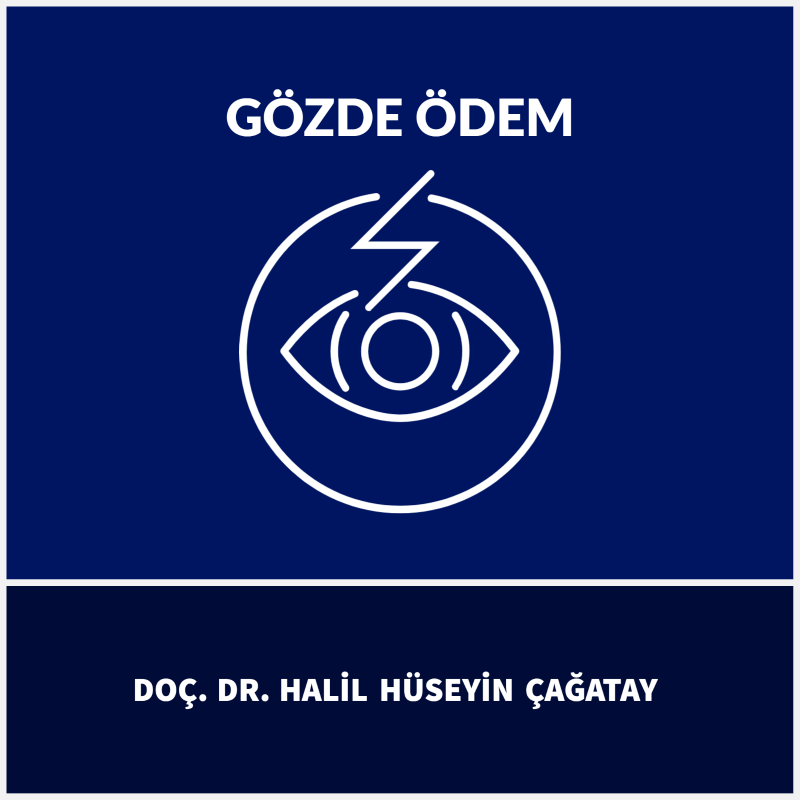Gözde Ödem