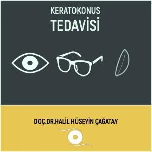 Keratokonus Tedavisi