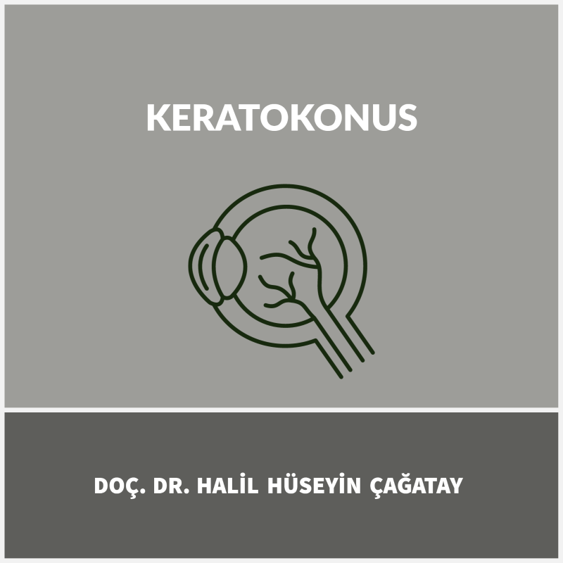 Keratokonus