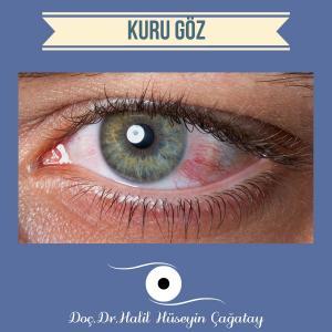 Kuru Göz