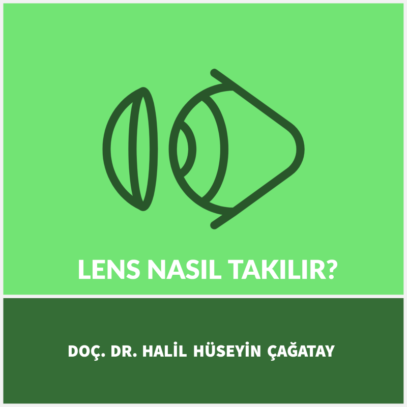 Lens Nasıl Takılır