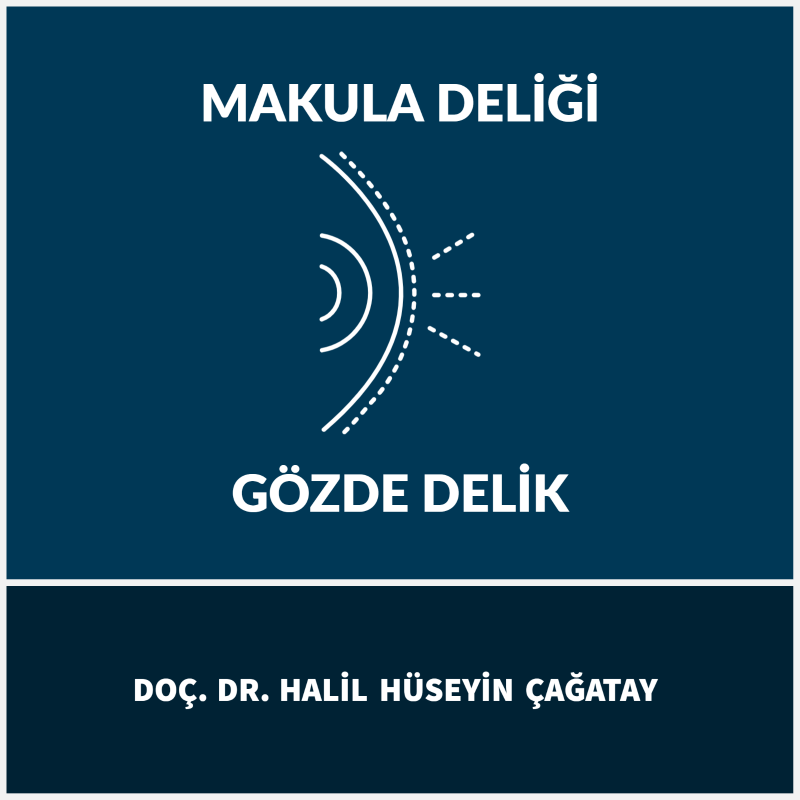 Makula Deliği