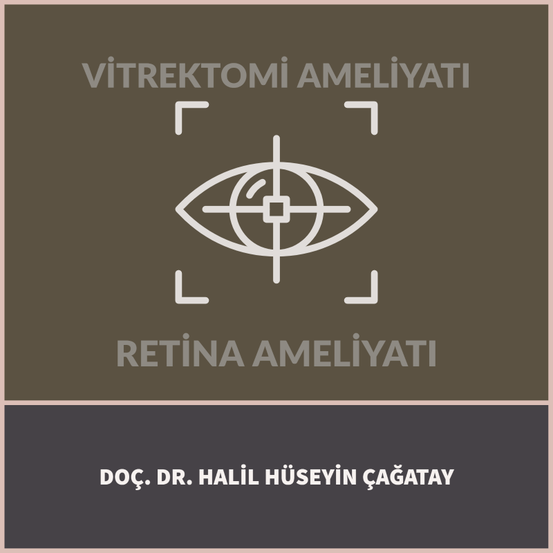 Retina Ameliyatı