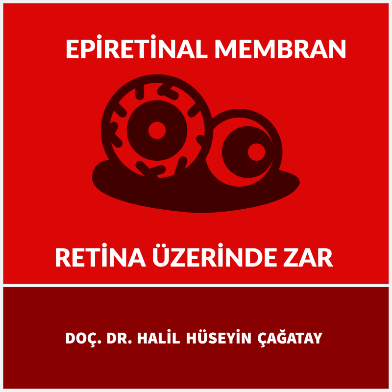 Retina Üzerinde Zar