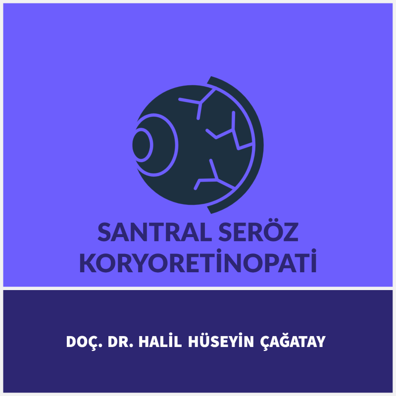 Santral Seröz Koryoretinopati