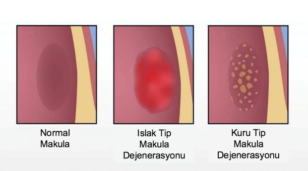 Sarı Nokta