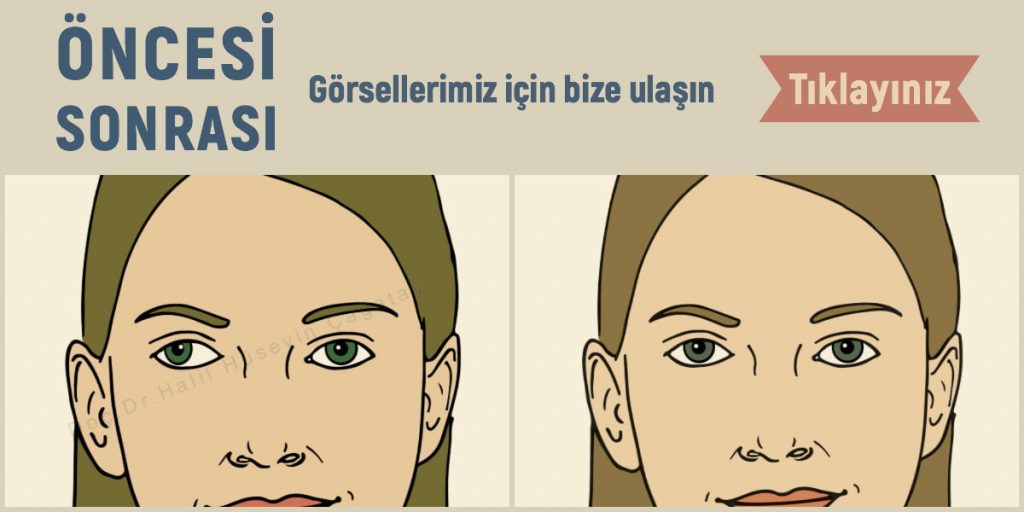 Öncesi Sonrası Görseller