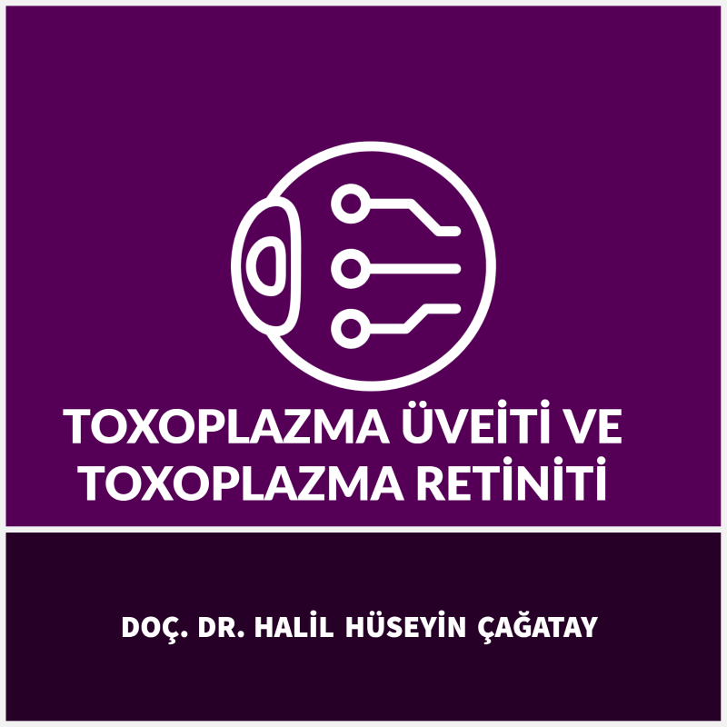 Toxoplazma Üveiti ve Toxoplazma Retiniti
