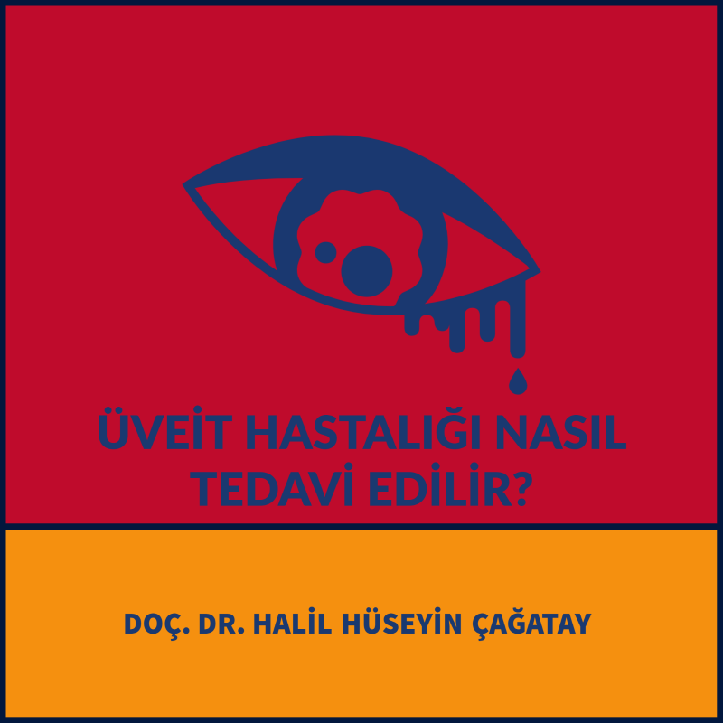 Üveit Hastalığı