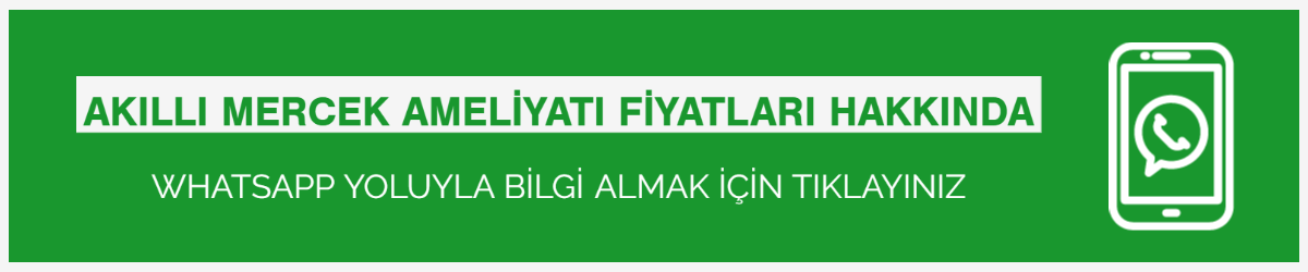 Akıllı Mercek
