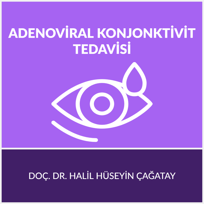 Adenoviral Konjonktivit Tedavisi