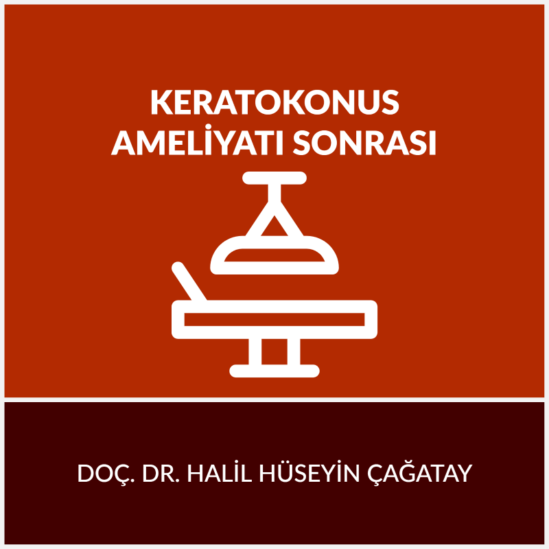 Keratokonus Ameliyat Sonrası