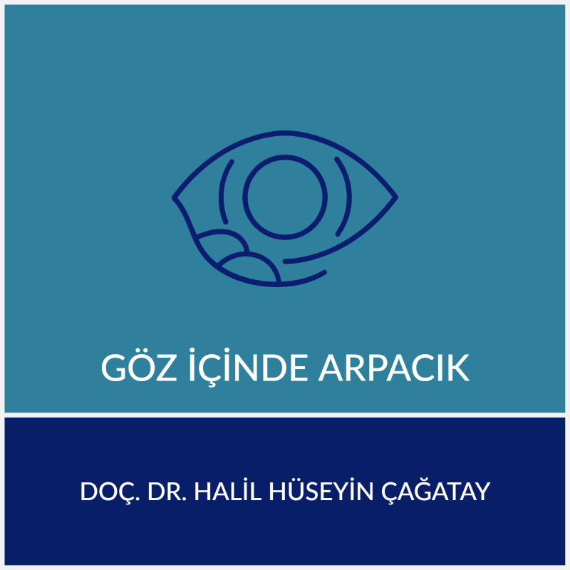Göz İçinde Arpacık