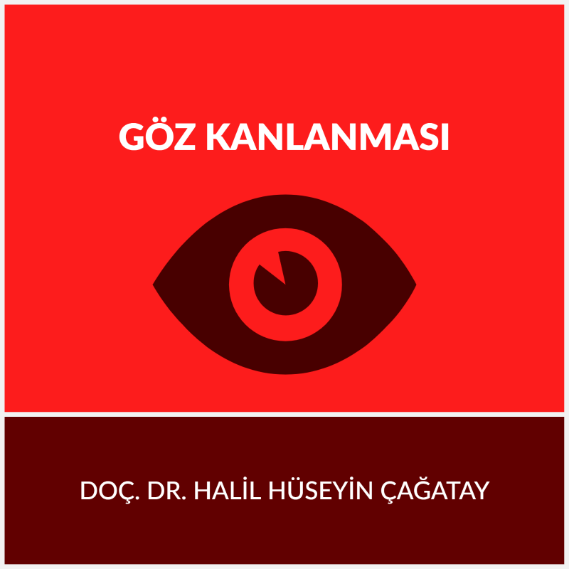 Göz Kanlanması