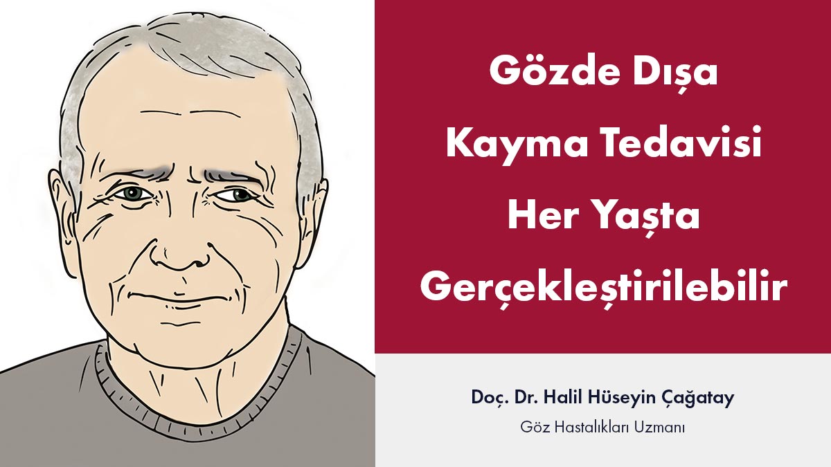 gözde dışa kayma tedavisi
