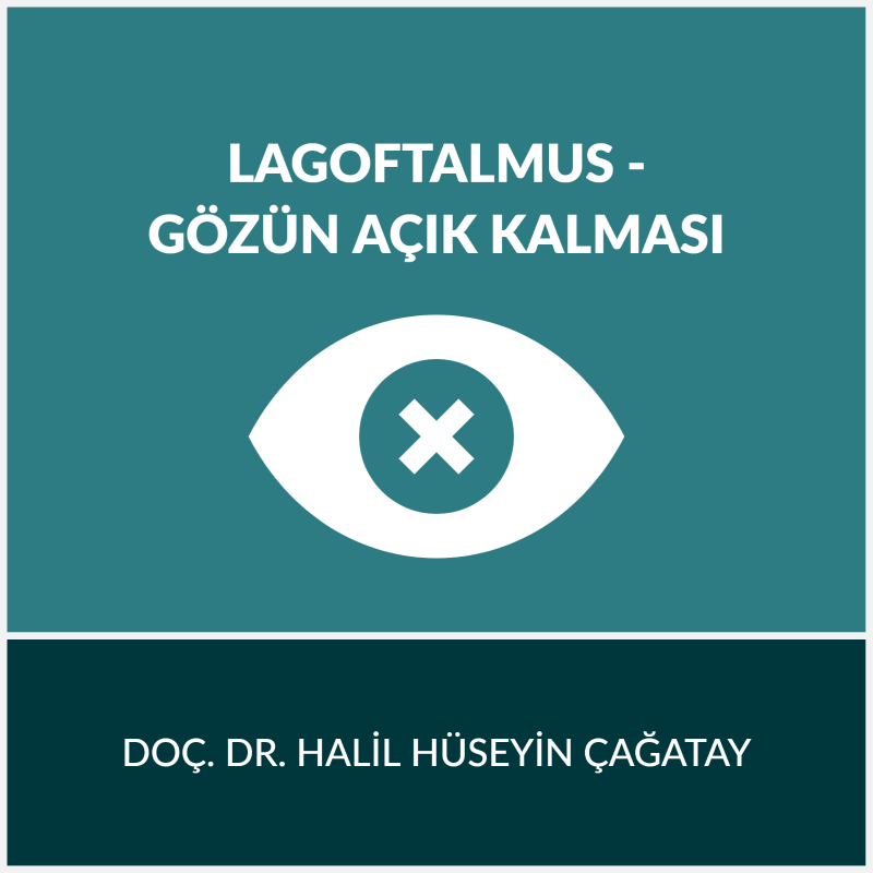 Gözün Açık Kalması