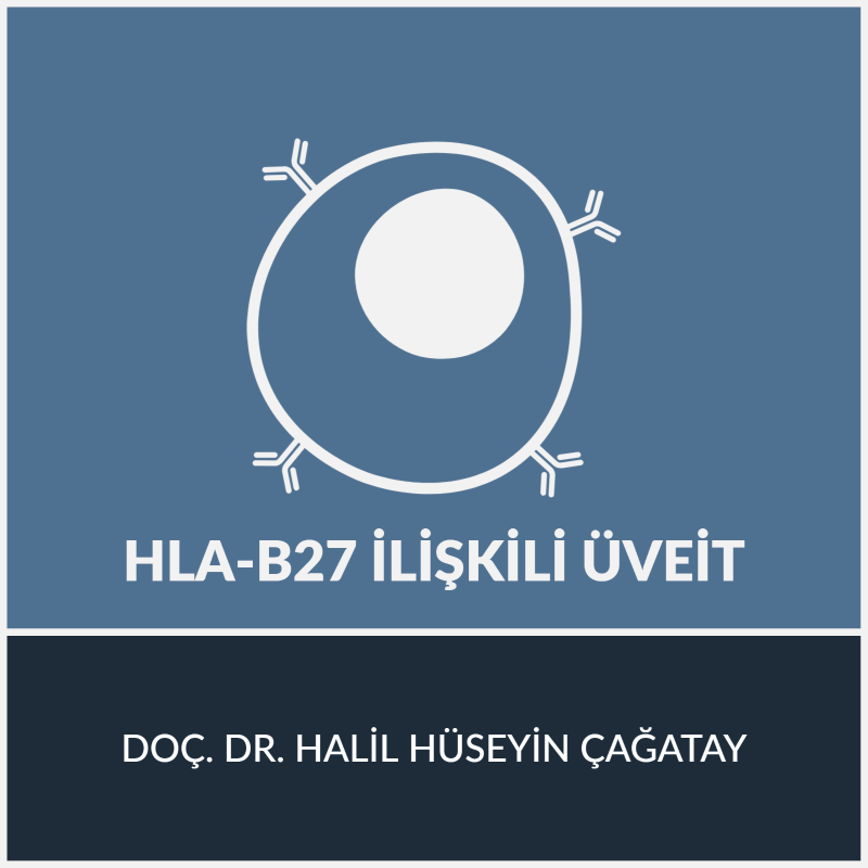 HLA B27 İlişkili Üveit