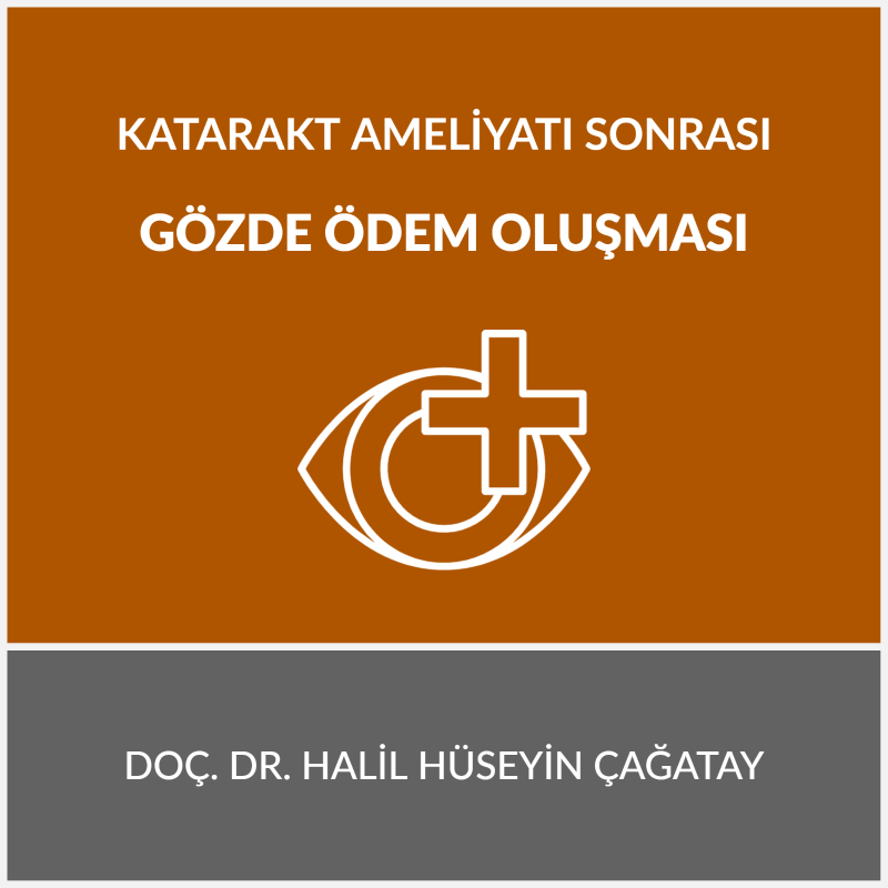 katarakt ameliyatı sonrası gözde ödem oluşması