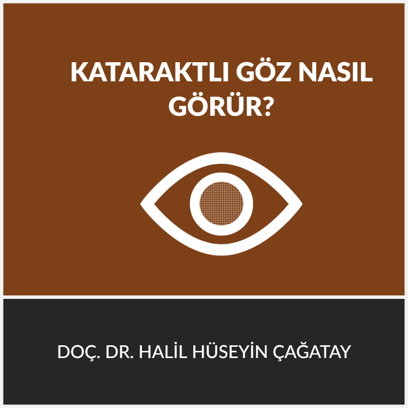 Kataraktlı Göz