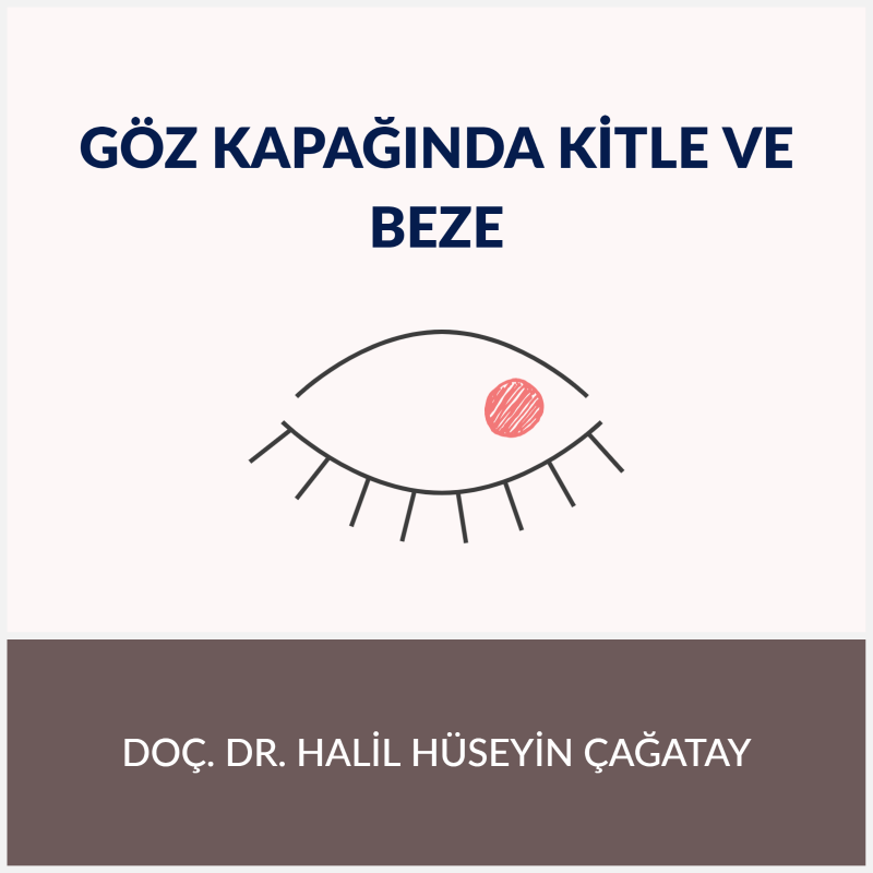 Göz Kapağında Kitle ve Beze