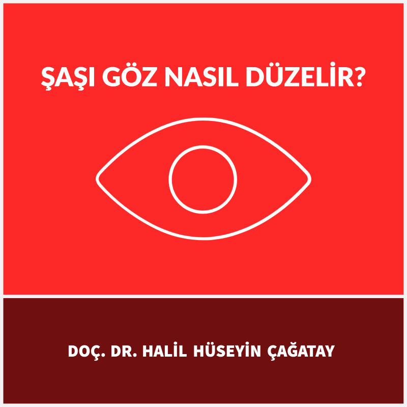 Şaşı Göz