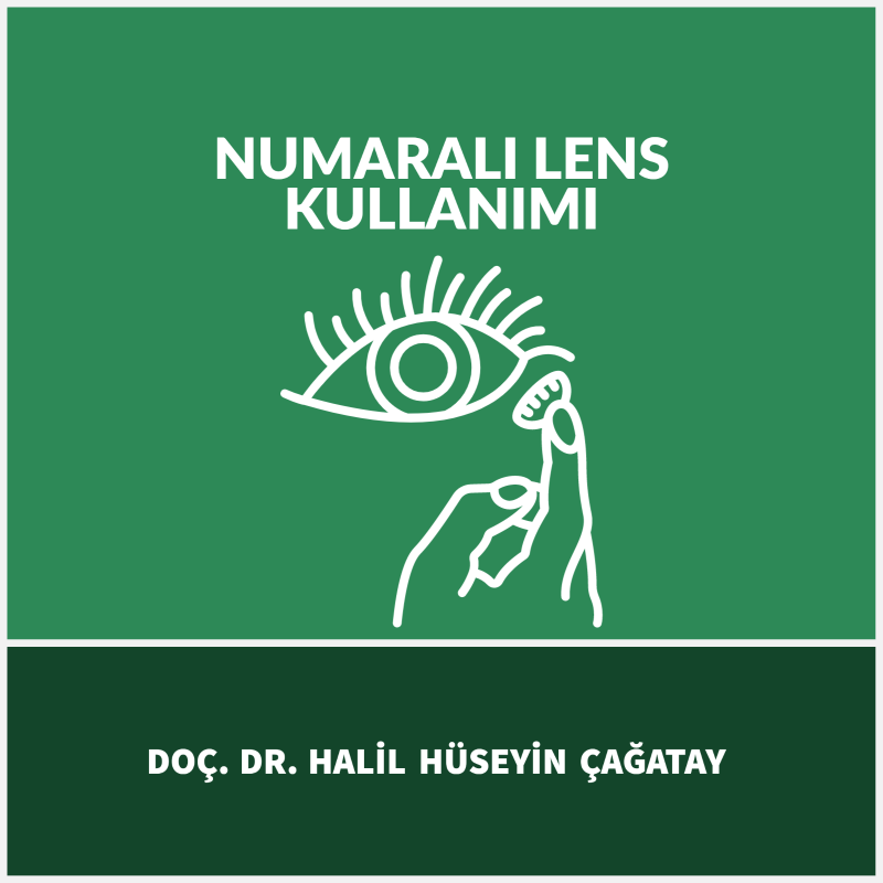 Numaralı Lens Kullanımı