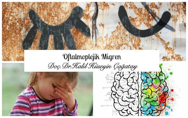 Oftalmoplejik Migren