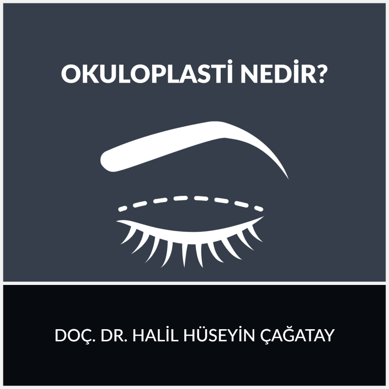 Okuloplasti
