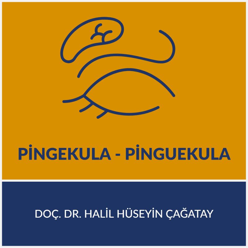 Pingekula